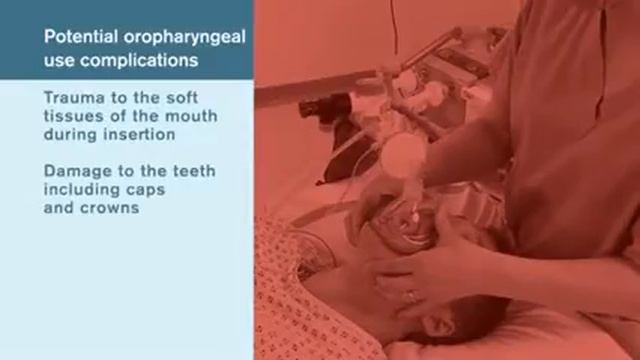 Проходимость дыхательных путей смотреть онлайн