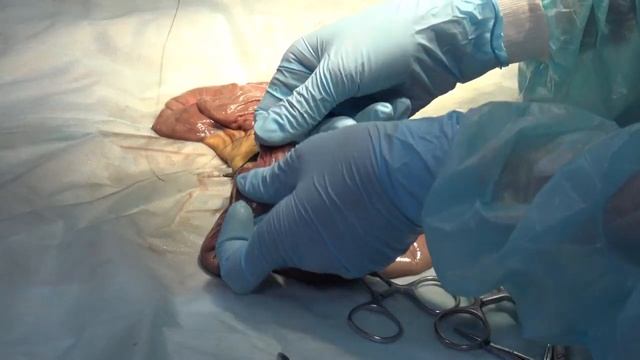 Мастер-класс. Урология часть 1 смотреть онлайн