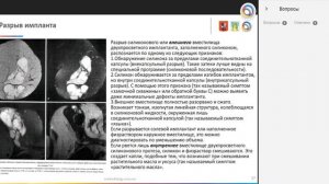 Особенности проведения МРТ молочных желез