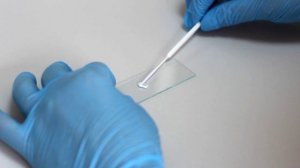 IMN 2 - Зонд урогенитальный