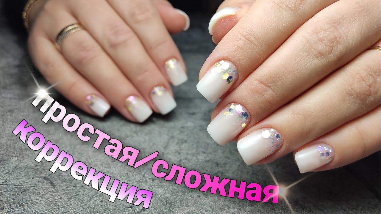 сложная коррекция по-простому/гипергидроз