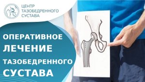 Операция тотального эндопротезирования тазобедренного сустава. Тотальное эндопротезирование. 18+
