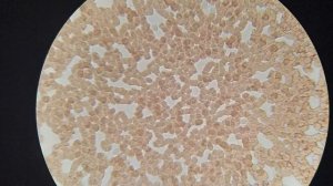 Бронекофе. Как изменится кровь