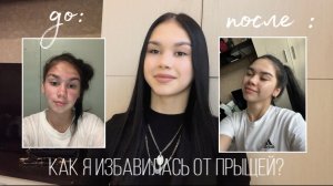КАК Я ИЗБАВИЛАСЬ ОТ ПРЫЩЕЙ | Мой опыт
