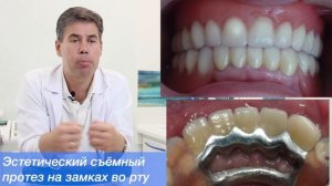 Съёмные протезы на замках.