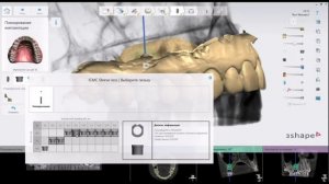 Виталий Панцулая: инструкция по созданию безвтулочного навигационного шаблона в 3Shape