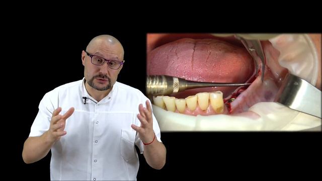 Курс по накостной фиксации СДТ