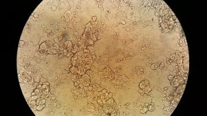 Настоящая наука: разрабатываем лекарство от ХОБЛ. День 6 начало.