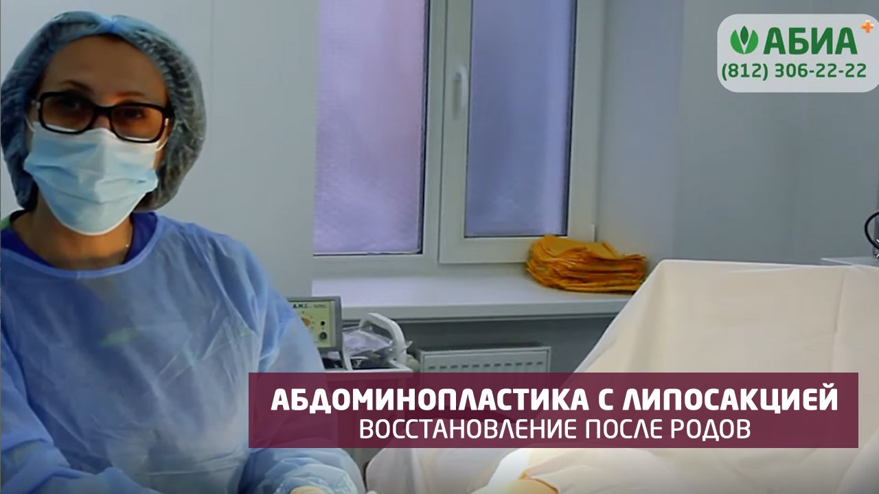 Абдоминопластика с липосакцией. Восстановление фигуры после родов
