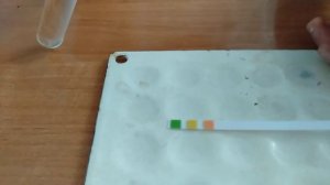 Обнаружение сахара в моче