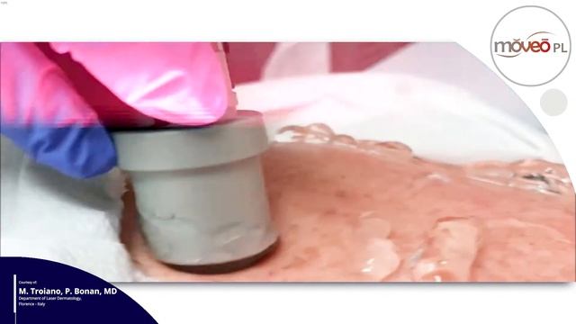 MOVEO PL - Decolleté Treatment смотреть онлайн