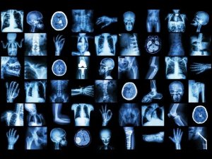 Общие вопросы патологической анатомии