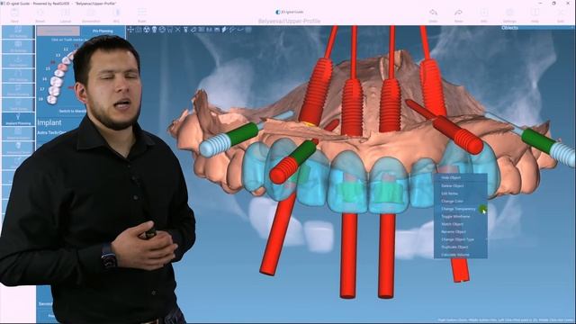 Планирование лечения при полной адентии. Концепция SmartFix. смотреть онлайн
