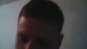 Дефислез. Закапавыем глаза