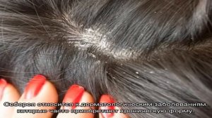 Сухая себорея кожи головы: лечение в домашних условиях