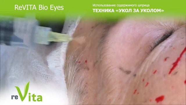 Premium reVita Bio EYES биоревитализант для периорбитальной области смотреть онлайн