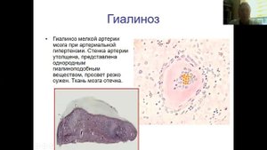 Мезенхимальные дитсрофии