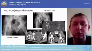 Вебинар "Лучевая диагностика заболеваний опорно-двигательной системы"