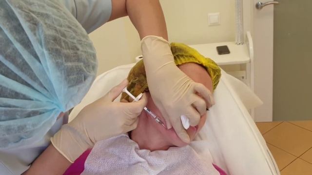 Контурная пластика и объемное моделирование.Ботулинотерапия.Ксеомин.Диспорт. Центр NEO. Магнитогорс смотреть онлайн