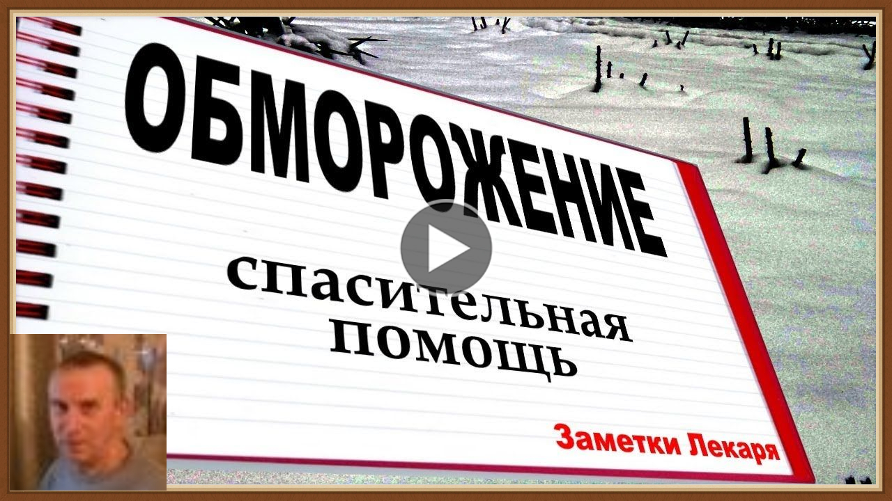 ОБМОРОЖЕНИЕ - ПРИЗНАКИ ПЕРВАЯ ПОМОЩЬ