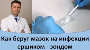 Как берут мазок на инфекции ершиком - зондом.