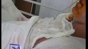 Облитая кипятком