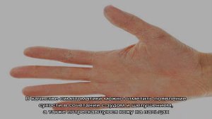 От чего лопается кожа на пальцах рук