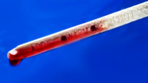 Что будет если залилить масло ATF в АКПП ВЫШЕ УРОВНЯ