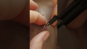 Снимаю швы после стерилизации котятам бурмы