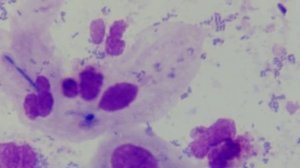 #мицелийДрожжеподобногоГриба  #молочница