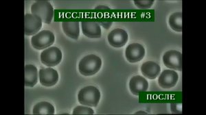 Клинические испытания продукции Youngevity на живых клетках крови