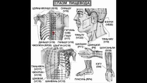 Как вылечить спазм пищевода. Эзофагит