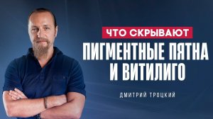 ЧТО СКРЫВАЮТ ПИГМЕНТНЫЕ ПЯТНА И ВИТИЛИГО