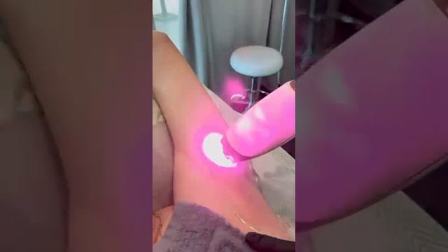 Лазерная эпиляция без боли в Краснодаре