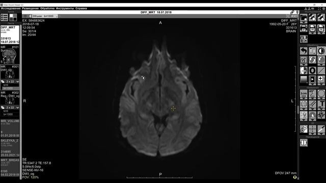 Обучающее видео "Интерфейс МРТ" смотреть онлайн