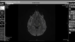 Обучающее видео "Интерфейс МРТ"