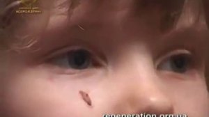 Иисус исцелил рак кожи ! Слава Господу во веки веков !!