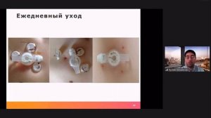Уход за гастростомой. Михайлов Р. Ш.