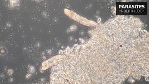 "Шерстяная рыбка"- или кожные сосальщики на теле рыб.