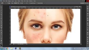 Как удалить прыщи с помощью Photoshop?