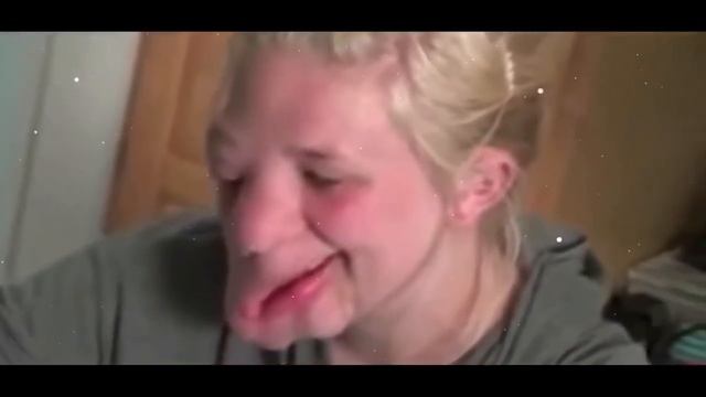 Отчим заметил, что лицо девочки начинает оплывать. Но врачи отказывались вмешиваться… смотреть онлайн