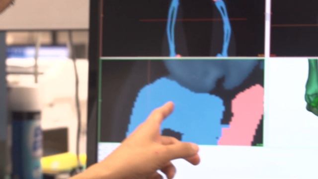 3-D Surgery A Game Changer For Veterinary Surgery At The University Of Florida