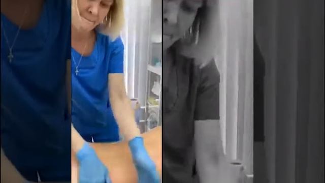 Карамельная липосакция