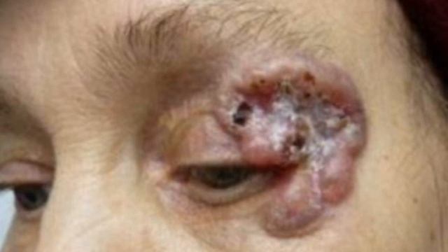 6. МЕДИЦИНА. Кофе канцероген. смотреть онлайн