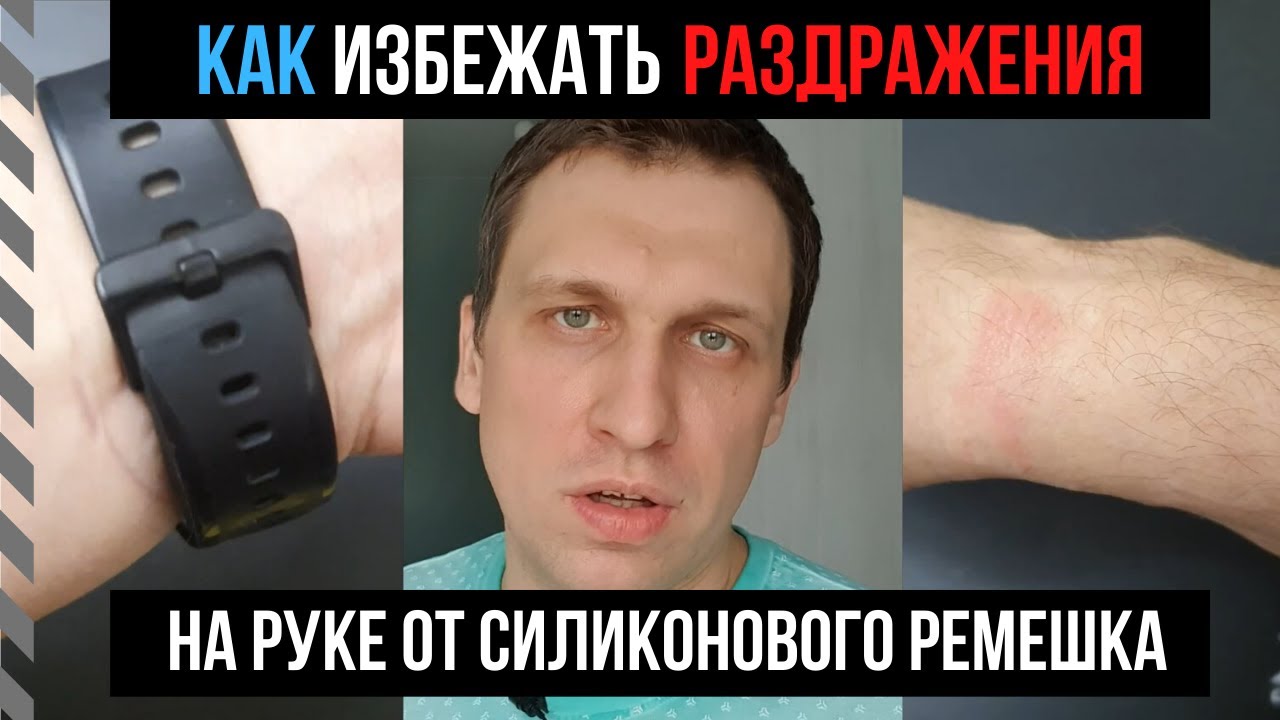 Как избежать раздражения на коже от силиконового ремешка умных часов Apple watch, Amazfit Bip?