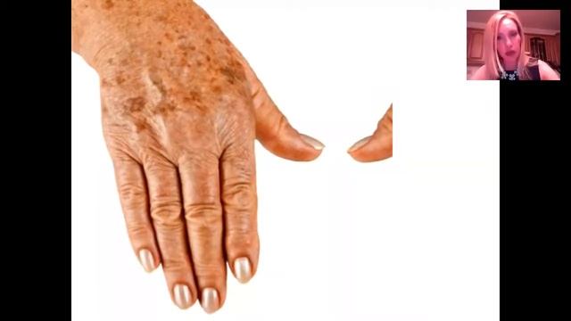 Возраст и возрастные изменения кожи. смотреть онлайн