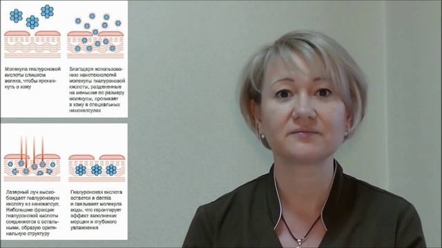 Вся правда о гиалуроновой кислоте смотреть онлайн