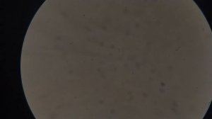 Какая ВОДА лучше для крови человека