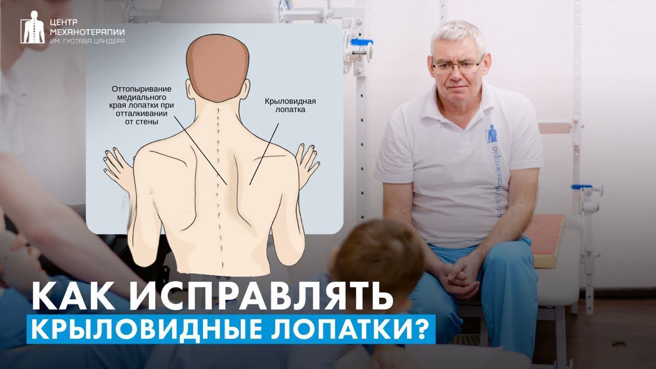 Крыловидные лопатки у ребенка: упражнения и советы что можно делать, а что нельзя.