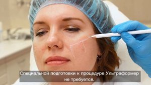 SMAS-лифтинг на аппарате Ультраформер